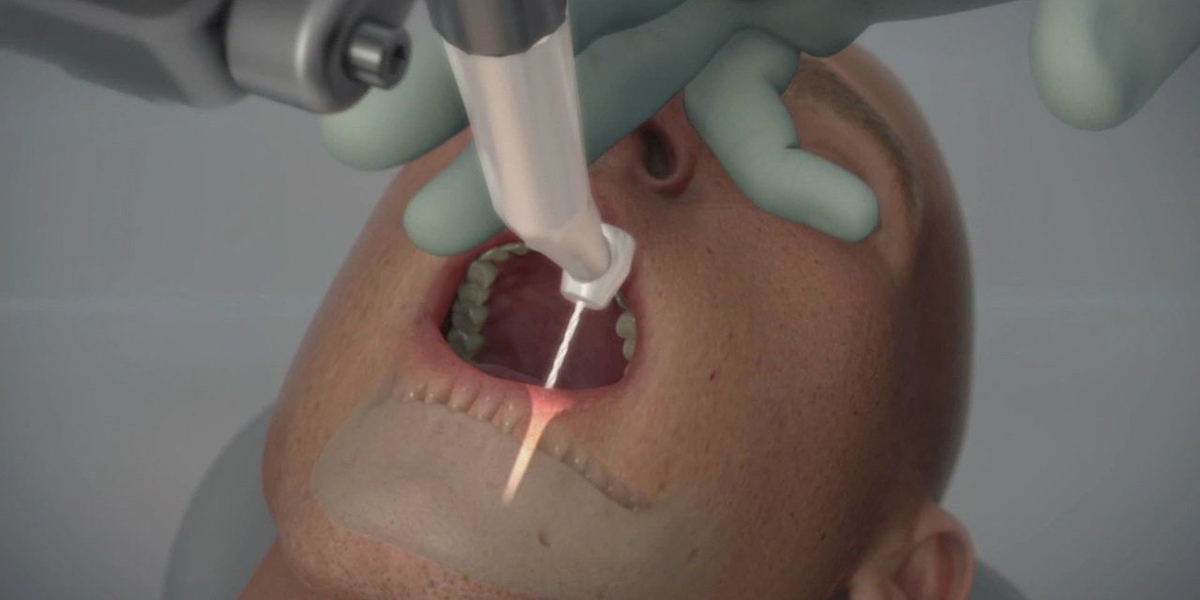 Robô dentista | Foto: Divulgação / Neocis